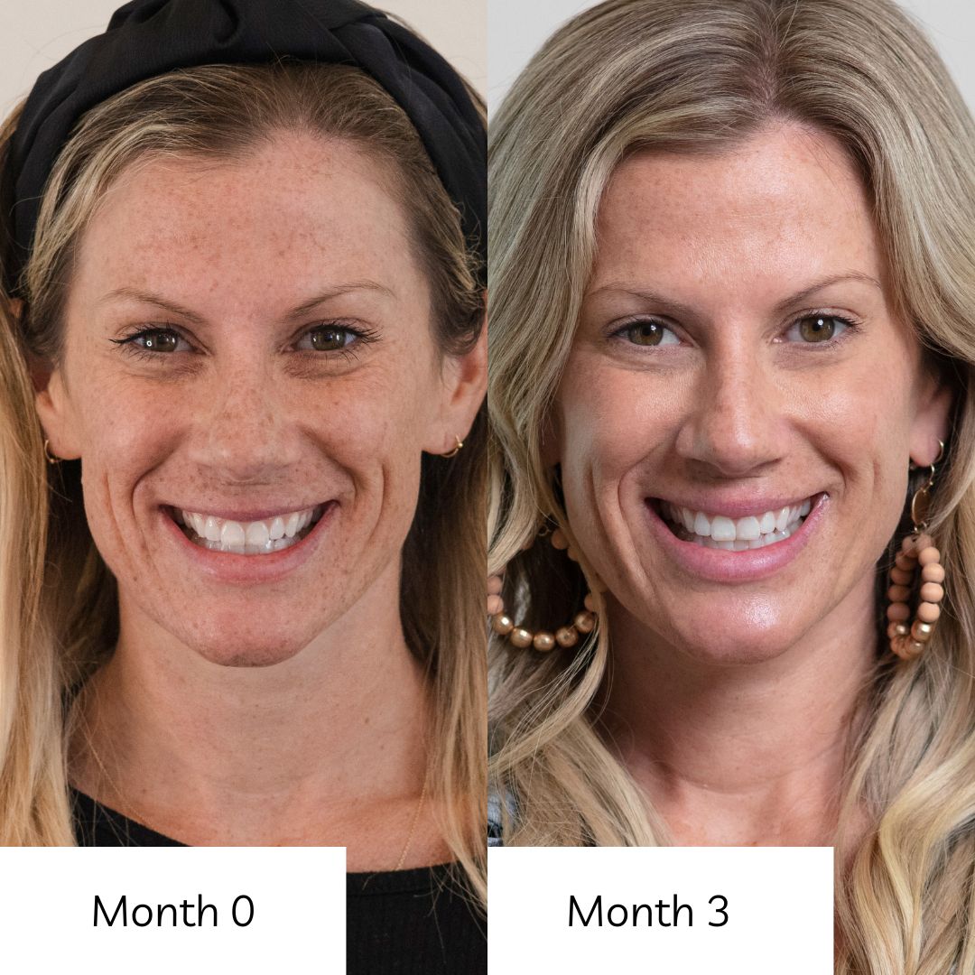 beauty infused collagen and ageless skin vitamins before and after photos