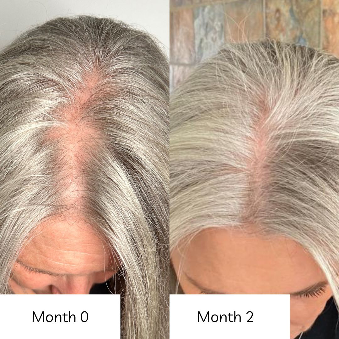 radiant hair growth vitamins before and after