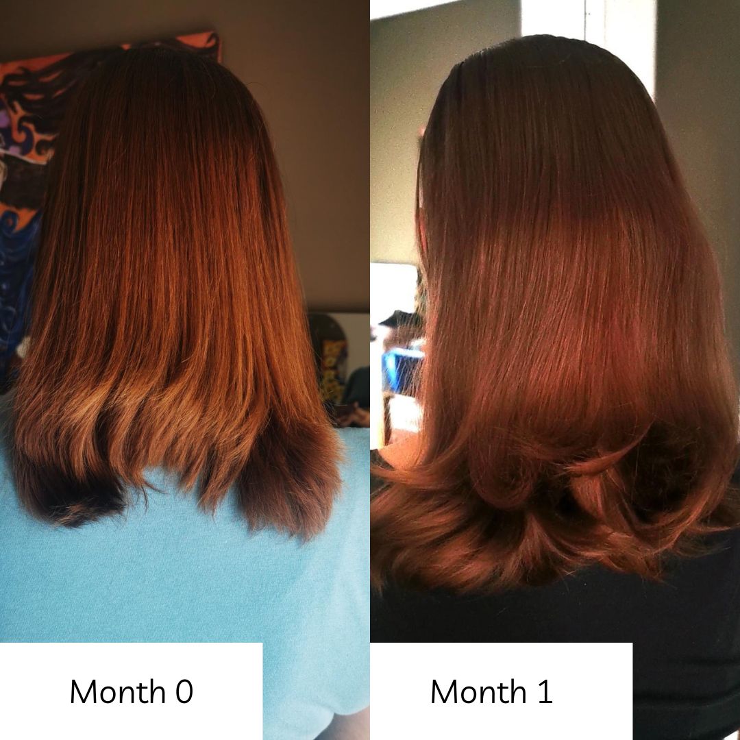 radiant hair growth vitamins before and after